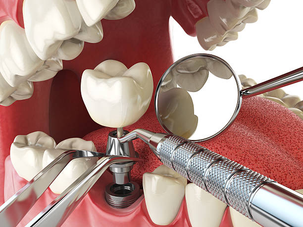 Best Emergency Dental Care for Trauma or Injury in Merrionette Park, IL